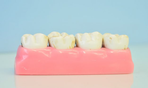 Wanneer verwijst de tandarts je door naar een mondhygiënist?